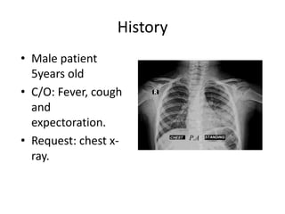History
• Male patient
5years old
• C/O: Fever, cough
and
expectoration.
• Request: chest x-
ray.
 