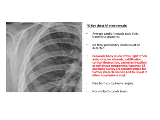 *X-Ray chest PA view reveals:
• Average cardio-thoracic ratio in its
transverse diameter.
• No focal pulmonary lesion could be
detected.
• Expansile bony lesion of the right 3rd rib
anteriorly, no sclerosis, calcification,
cortical destruction, periosteal reaction
or soft tissue component, however, CT
and bone survey are recommended for
further characterization and to reveal if
other bony lesions exist.
• Free both costophrenic angles.
• Normal both copula levels.
 