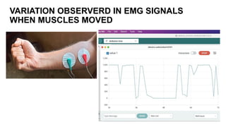 VARIATION OBSERVERD IN EMG SIGNALS
WHEN MUSCLES MOVED
 