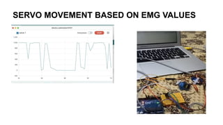 SERVO MOVEMENT BASED ON EMG VALUES
 