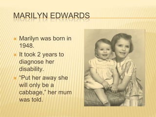 Marilyn Edwards Marilyn was born in 1948.  It took 2 years to diagnose her disability. “Put her away she will only be a cabbage,” her mum was told. 