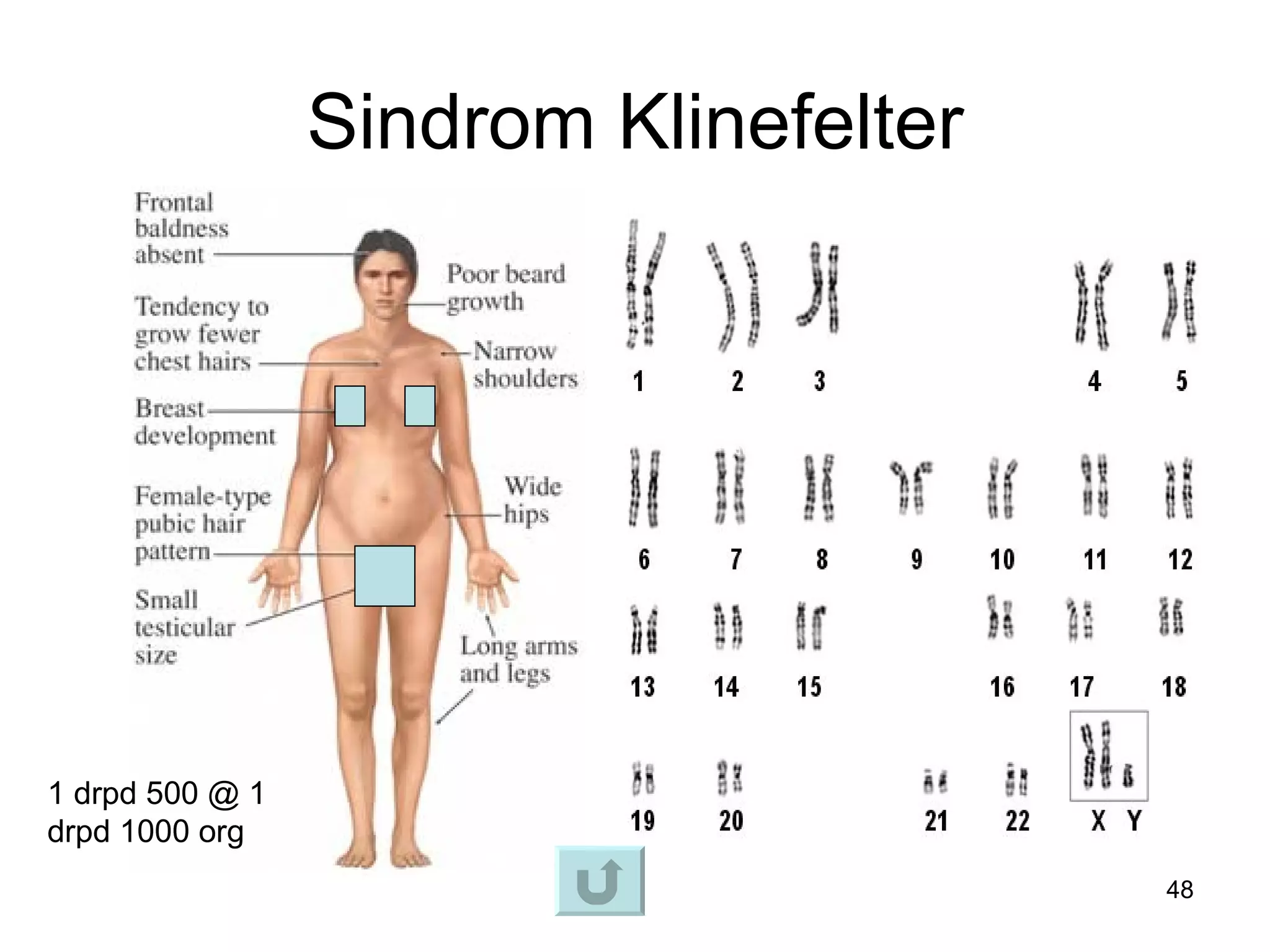 Sindrom Klinefelter




1 drpd 500 @ 1
drpd 1000 org
                                       48
 