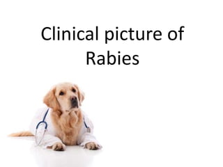 Clinical picture of
Rabies
 