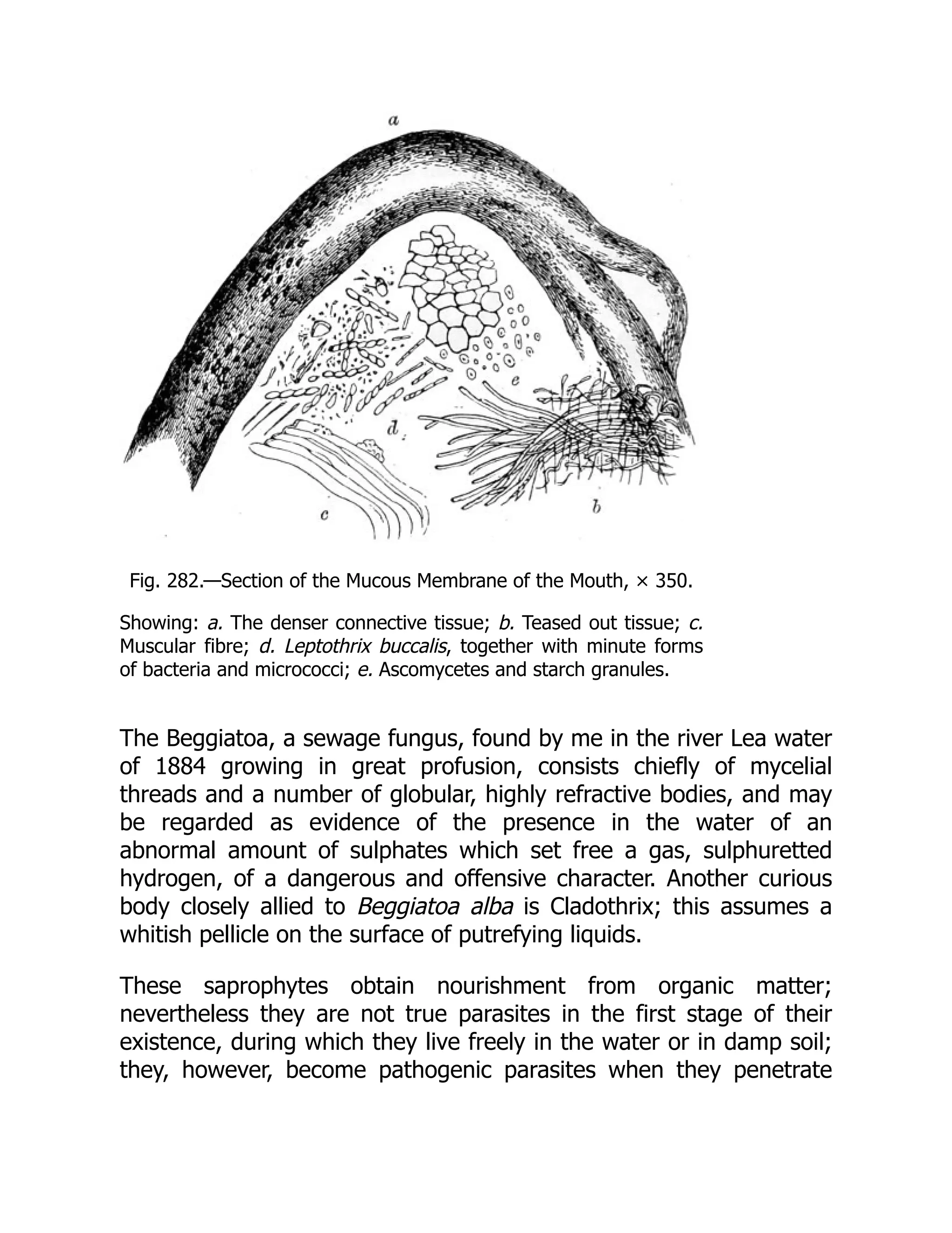 Fig. 282.—Section of the Mucous Membrane of the Mouth, × 350. Showing: a. The denser connective tissue; b. Teased out tissue; c. Muscular fibre; d. Leptothrix buccalis, together with minute forms of bacteria and micrococci; e. Ascomycetes and starch granules. The Beggiatoa, a sewage fungus, found by me in the river Lea water of 1884 growing in great profusion, consists chiefly of mycelial threads and a number of globular, highly refractive bodies, and may be regarded as evidence of the presence in the water of an abnormal amount of sulphates which set free a gas, sulphuretted hydrogen, of a dangerous and offensive character. Another curious body closely allied to Beggiatoa alba is Cladothrix; this assumes a whitish pellicle on the surface of putrefying liquids. These saprophytes obtain nourishment from organic matter; nevertheless they are not true parasites in the first stage of their existence, during which they live freely in the water or in damp soil; they, however, become pathogenic parasites when they penetrate 