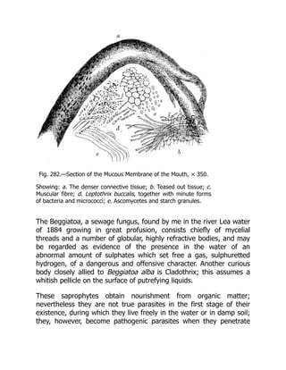 Fig. 282.—Section of the Mucous Membrane of the Mouth, × 350.
Showing: a. The denser connective tissue; b. Teased out tissue; c.
Muscular fibre; d. Leptothrix buccalis, together with minute forms
of bacteria and micrococci; e. Ascomycetes and starch granules.
The Beggiatoa, a sewage fungus, found by me in the river Lea water
of 1884 growing in great profusion, consists chiefly of mycelial
threads and a number of globular, highly refractive bodies, and may
be regarded as evidence of the presence in the water of an
abnormal amount of sulphates which set free a gas, sulphuretted
hydrogen, of a dangerous and offensive character. Another curious
body closely allied to Beggiatoa alba is Cladothrix; this assumes a
whitish pellicle on the surface of putrefying liquids.
These saprophytes obtain nourishment from organic matter;
nevertheless they are not true parasites in the first stage of their
existence, during which they live freely in the water or in damp soil;
they, however, become pathogenic parasites when they penetrate
 