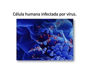 Célula humana infectada por vírus.
 