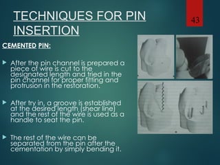 Restorations that are used to replace any missing structure of teeth ...