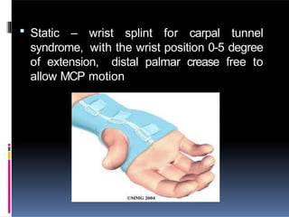  Static – wrist splint for carpal tunnel
syndrome, with the wrist position 0-5 degree
of extension, distal palmar crease free to
allow MCP motion
 