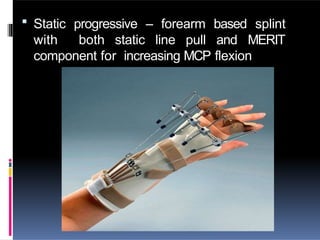  Static progressive – forearm based splint
with both static line pull and MERIT
component for increasing MCP flexion
 