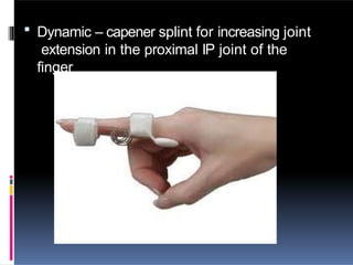  Dynamic – capener splint for increasing joint
extension in the proximal IP joint of the
finger
 