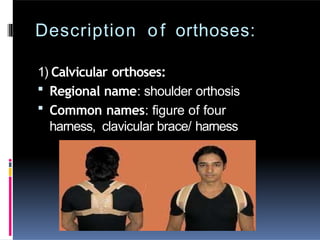 Description of orthoses:
1) Calvicular orthoses:
 Regional name: shoulder orthosis
 Common names: figure of four
harness, clavicular brace/ harness
 