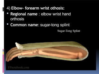 4) Elbow- forearm wrist othosis:
 Regional name : elbow wrist hand
orthosis
 Common name: sugar-tong splint
 