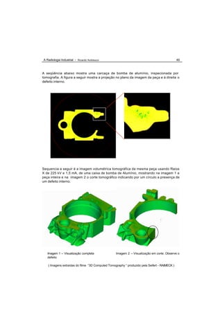 A Radiologia Industrial - Ricardo Andreucci                                                    49



A seqüência abaixo mostra uma carcaça de bomba de alumínio, inspecionada por
tomografia. A figura a seguir mostra a projeção no plano da imagem da peça e à direita o
defeito interno.




Sequencia a seguir é a imagem volumétrica tomográfica da mesma peça usando Raios
X de 225 kV e 1,5 mA, de uma caixa de bomba de Alumínio, mostrando na imagem 1 a
peça inteira e na imagem 2 o corte tomográfico indicando por um círculo a presença de
um defeito interno.




   Imagem 1 – Visualização completa               Imagem 2 – Visualização em corte. Observe o
   defeito

   ( Imagens extraídas do filme “3D Computed Tomography “ produzido pela Seifert - RAIMECK )
 
