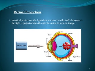 Retinal Projection
o In retinal projection, the light does not have to reflect off of an object.
the light is projected directly onto the retina to form an image.
16
 
