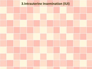 3.Intrauterine Insemination (IUI)
 