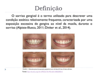 Definição
O sorriso gengival é o termo utilizado para descrever uma
condição estética relativamente frequente, caracterizada por uma
exposição excessiva de gengiva ao nível da maxila, durante o
sorriso (Alpiste-Illueca, 2011; Dinker et al., 2014).
Fonte:http://dx.doi.org/10.1590/S2176-94512011000200016
 