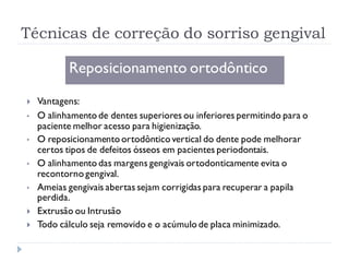 Técnicas de correção do sorriso gengival
Reposicionamento ortodôntico
 Vantagens:
• O alinhamento de dentes superiores ou inferiores permitindo para o
paciente melhor acesso para higienização.
• O reposicionamento ortodôntico vertical do dente pode melhorar
certos tipos de defeitos ósseos em pacientes periodontais.
• O alinhamento das margens gengivais ortodonticamente evita o
recontorno gengival.
• Ameias gengivais abertas sejam corrigidas para recuperar a papila
perdida.
 Extrusão ou Intrusão
 Todo cálculo seja removido e o acúmulo de placa minimizado.
 