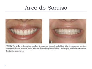 Arco do Sorriso
 