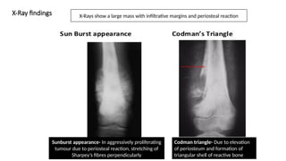 Bone tumors histology pathology and case discussions | PPTX