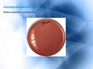 Fundamento

Staphylococcus aureus es un microorganismo que puede causar intoxicación
alimentaria, y para su aislamiento, p...
