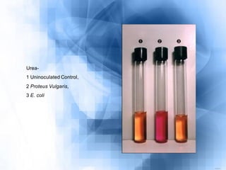 5203044 medios-de-cultivo-y-pruebas-bioquimicas