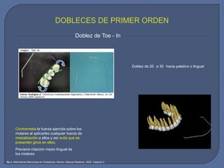 Doblez de Toe - In
Doblez de 20 a 30 hacia palatino o lingual
Previene rotación mesio lingual de
los molares
Contrarresta la fuerza ejercida sobre los
molares al aplicarles cualquier fuerza de
mesialización a ellos y así evita que se
presenten giros en ellos.
Ito J: Alternativas Mecánicas en Ortodoncia. México: Manual Moderno, 2002. Capítulo 2.
 