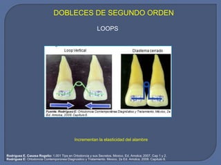DOBLECES DE SEGUNDO ORDEN
LOOPS
Incrementan la elasticidad del alambre
Rodríguez E: Ortodoncia Contemporánea Diagnóstico y Tratamiento. México, 2a Ed. Amolca, 2008. Capítulo 8.
Rodríguez E, Casasa Rogelio: 1.001 Tips en Ortodoncia y sus Secretos. México. Ed. Amolca; 2007. Cap 1 y 2.
 