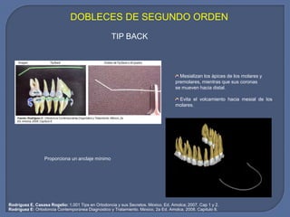 TIP BACK
Mesializan los ápices de los molares y
premolares, mientras que sus coronas
se mueven hacia distal.
Evita el volcamiento hacia mesial de los
molares.
DOBLECES DE SEGUNDO ORDEN
Rodríguez E, Casasa Rogelio: 1.001 Tips en Ortodoncia y sus Secretos. México. Ed. Amolca; 2007. Cap 1 y 2.
Rodríguez E: Ortodoncia Contemporánea Diagnóstico y Tratamiento. México, 2a Ed. Amolca, 2008. Capítulo 8.
Proporciona un anclaje mínimo
 