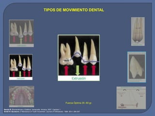TIPOS DE MOVIMIENTO DENTAL
Fuerza Óptima 35 -60 gr.
Nanda R: Biomecánicas y Estética. Venezuela: Amolca, 2007. Capítulo 1.
Smith R. Burstone J: Mechanics of Tooth movement. Journal of Orthodontic. 1984. 85-4. 294-307.
 