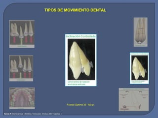 TIPOS DE MOVIMIENTO DENTAL
Nanda R: Biomecánicas y Estética. Venezuela: Amolca, 2007. Capítulo 1.
Fuerza Óptima 35 - 60 gr.
 