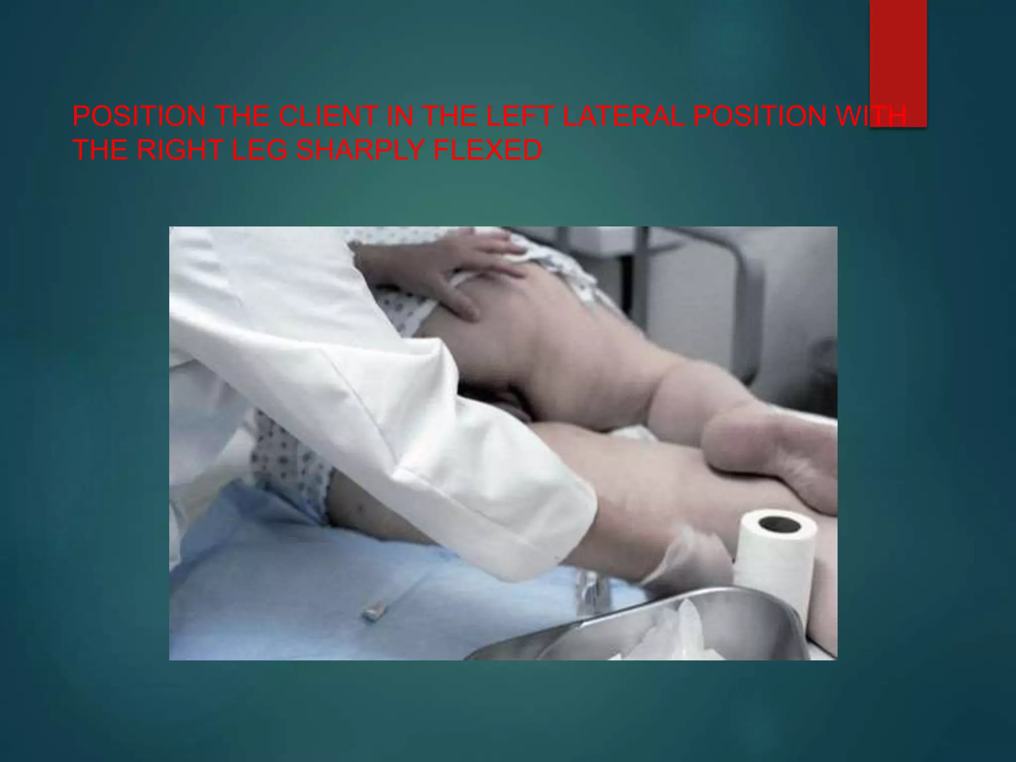 POSITION THE CLIENT IN THE LEFT LATERAL POSITION WITH
THE RIGHT LEG SHARPLY FLEXED
 