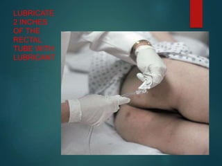LUBRICATE
2 INCHES
OF THE
RECTAL
TUBE WITH
LUBRICANT
 