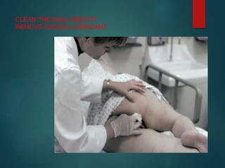 CLEAN THE ANAL AREA TO
REMOVE EXCESS LUBRICANT
 