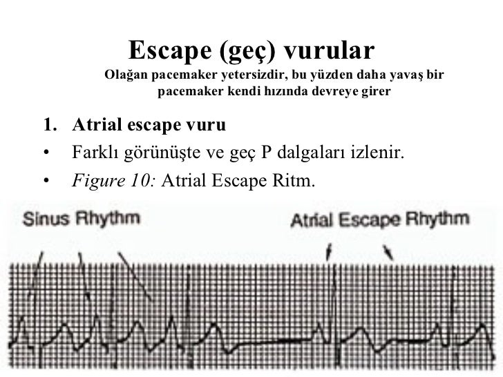 Oncomarker CA 19-9. CA 19-9un analizi: norm ve yüksek olduğu zaman 77