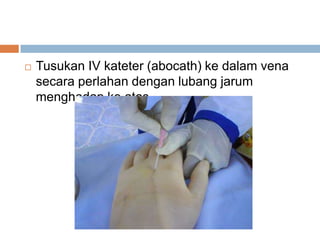  Tusukan IV kateter (abocath) ke dalam vena
secara perlahan dengan lubang jarum
menghadap ke atas.
 