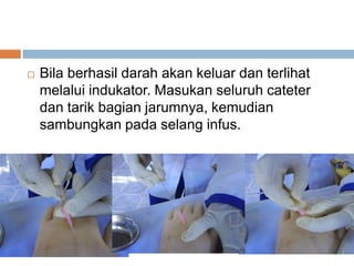  Bila berhasil darah akan keluar dan terlihat
melalui indukator. Masukan seluruh cateter
dan tarik bagian jarumnya, kemudian
sambungkan pada selang infus.
 