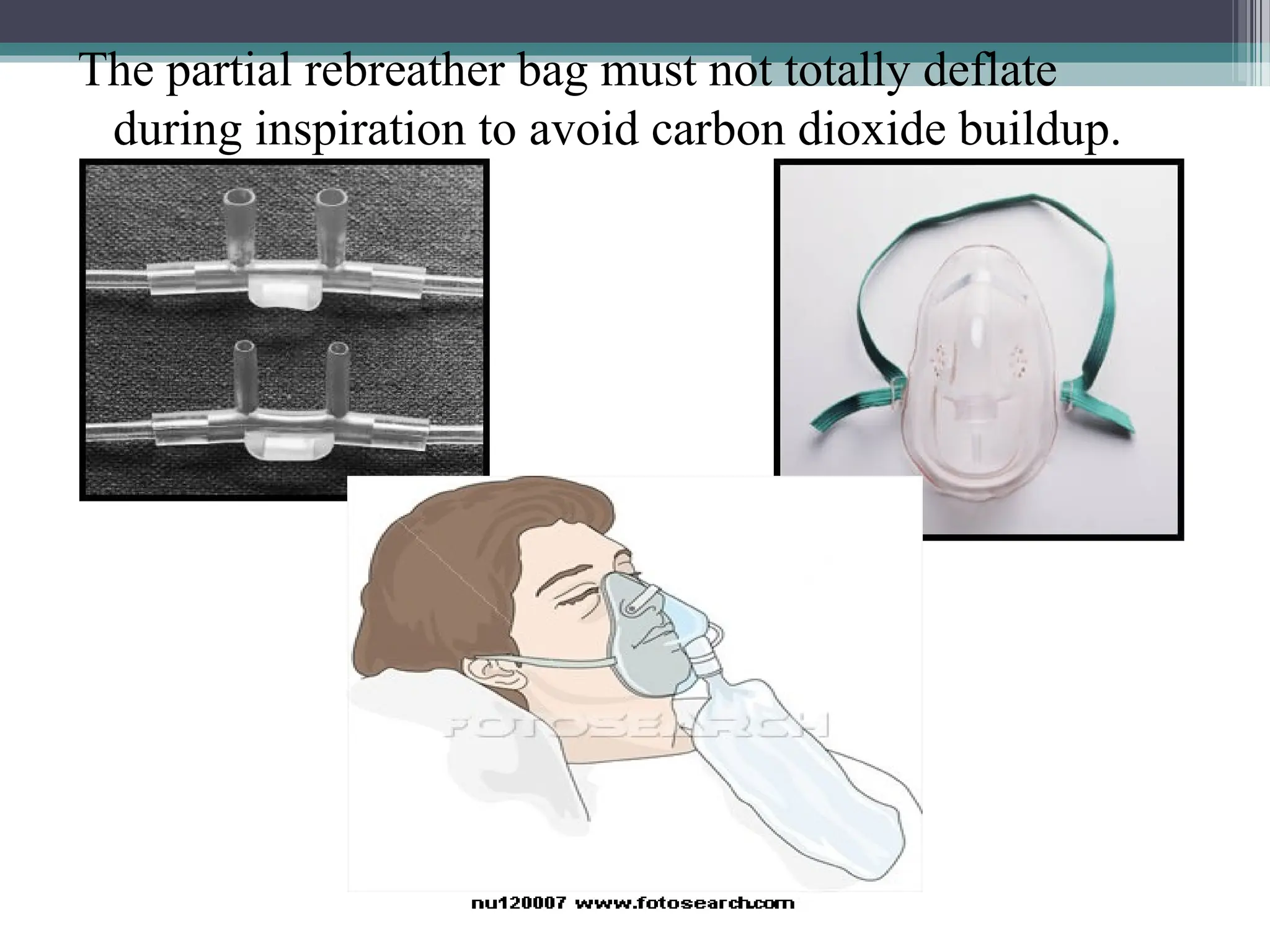 The partial rebreather bag must not totally deflate
during inspiration to avoid carbon dioxide buildup.
 