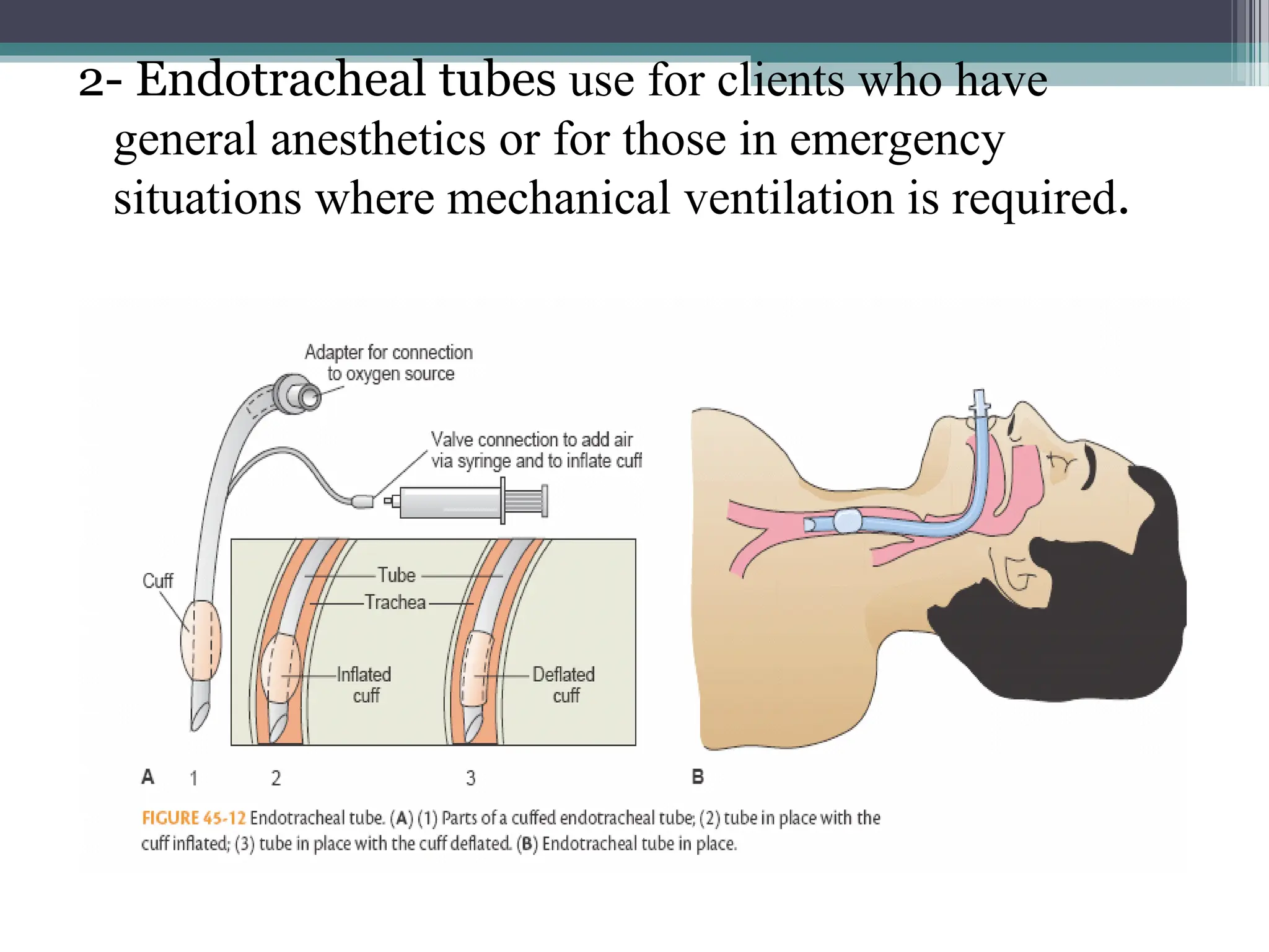 2- Endotracheal tubes use for clients who have
general anesthetics or for those in emergency
situations where mechanical ventilation is required.
 