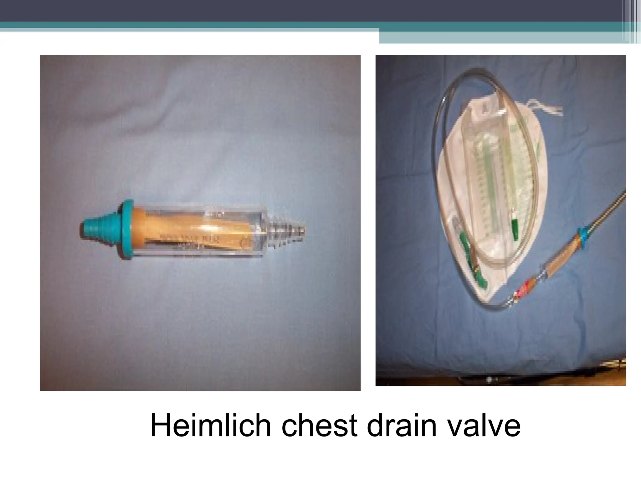 Heimlich chest drain valve
 