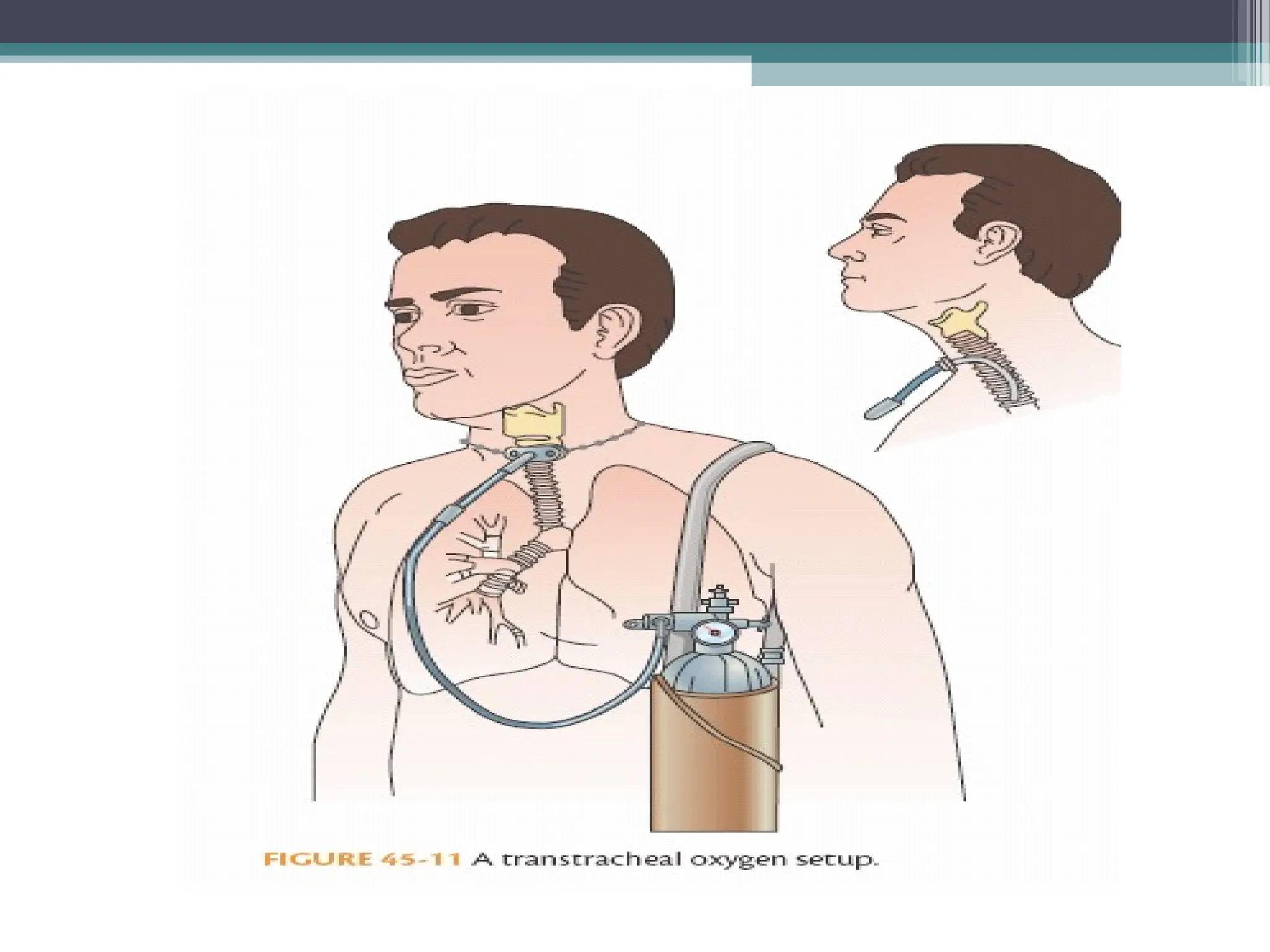 management of client with oxygenation problems