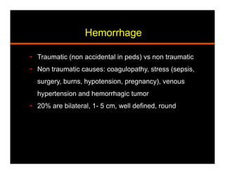 Hemorrhage
•  Traumatic (non accidental in peds) vs non traumatic
•  Non traumatic causes: coagulopathy, stress (sepsis,
surgery, burns, hypotension, pregnancy), venous
hypertension and hemorrhagic tumor
•  20% are bilateral, 1- 5 cm, well defined, round
 