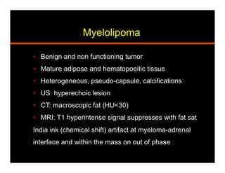 Myelolipoma
•  Benign and non functioning tumor
•  Mature adipose and hematopoeitic tissue
•  Heterogeneous, pseudo-capsule, calcifications
•  US: hyperechoic lesion
•  CT: macroscopic fat (HU<30)
•  MRI: T1 hyperintense signal suppresses with fat sat
India ink (chemical shift) artifact at myeloma-adrenal
interface and within the mass on out of phase
 