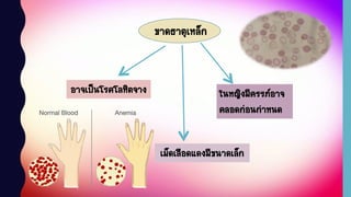 ขาดธาตุเหล็ก
อาจเป็นโรคโลหิตจาง
เม็ดเลือดแดงมีขนาดเล็ก
ในหญิงมีครรภ์อาจ
คลอดก่อนกาหนด
 