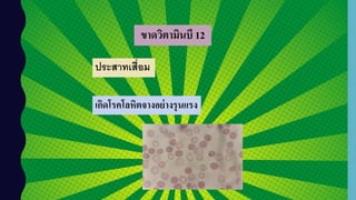ขาดวิตามินบี 12
เกิดโรคโลหิตจางอย่างรุนแรง
ประสาทเสื่อม
 