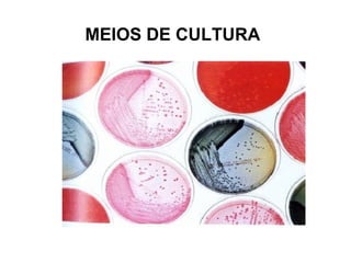 MEIOS DE CULTURA
 