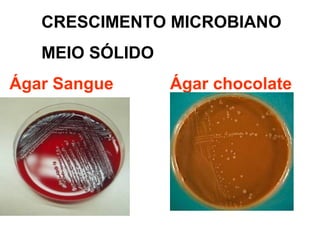 CRESCIMENTO MICROBIANO
MEIO SÓLIDO
Ágar Sangue Ágar chocolate
 