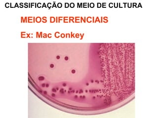 CLASSIFICAÇÃO DO MEIO DE CULTURA
MEIOS DIFERENCIAIS
Ex: Mac Conkey
 