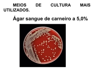 MEIOS DE CULTURA MAIS
UTILIZADOS.
Ágar sangue de carneiro a 5,0%
 