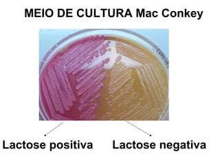 MEIO DE CULTURA Mac Conkey
Lactose positiva Lactose negativa
 