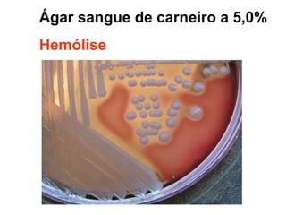 Ágar sangue de carneiro a 5,0%
Hemólise
 